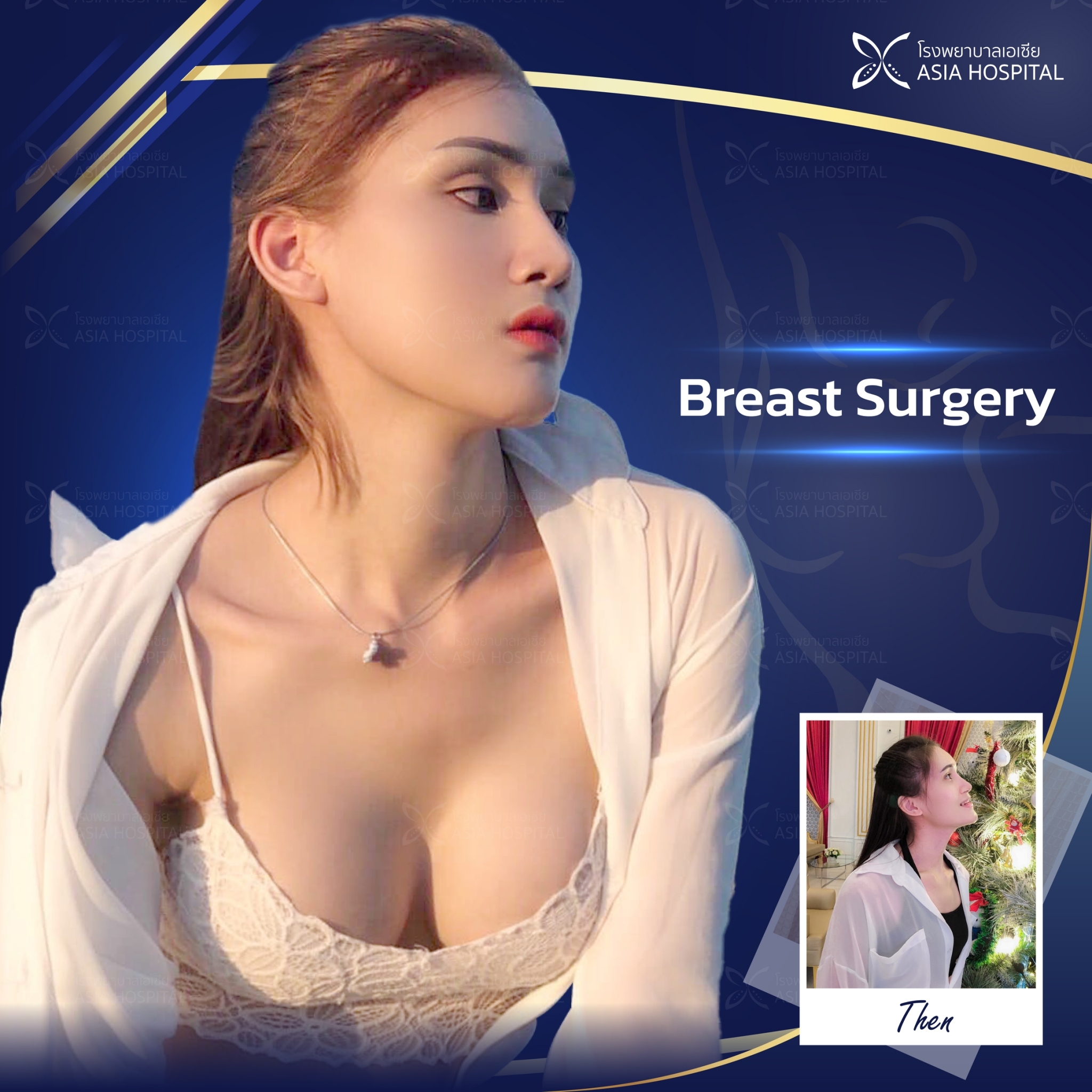 Thailand-Breast-Surgery