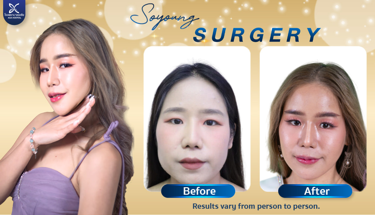 Jaw Angle Reduction Surgery