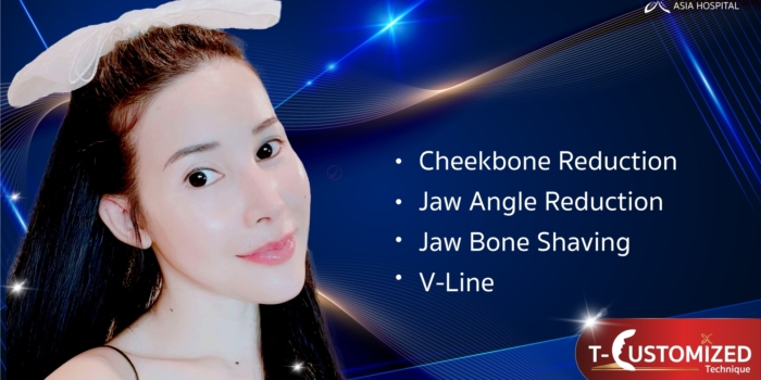 Cheekbone Reduction