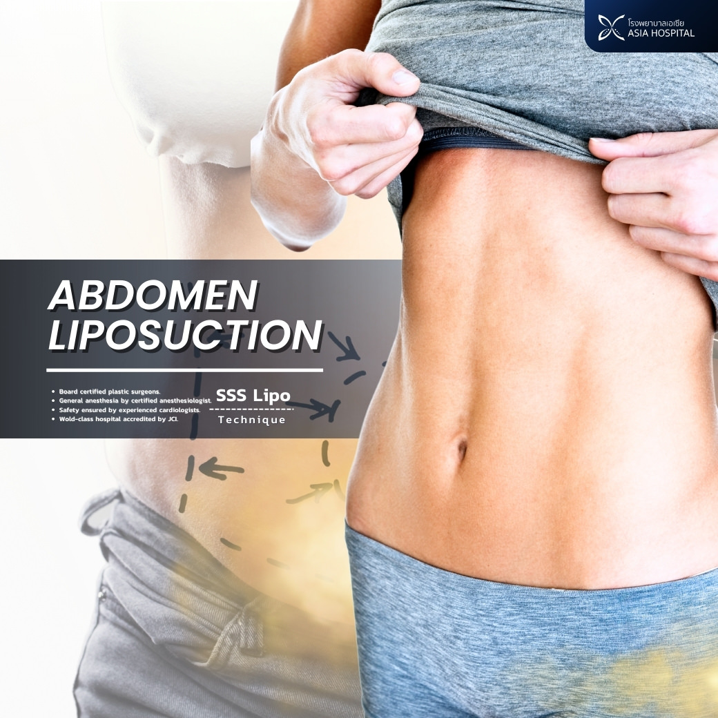 Liposuction